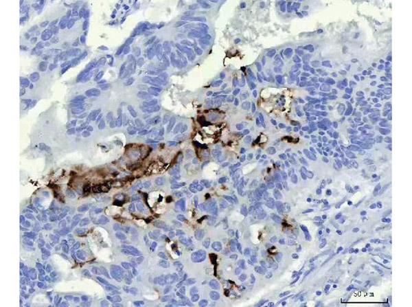 Immunohistochemistry analysis of Mucin Gastric